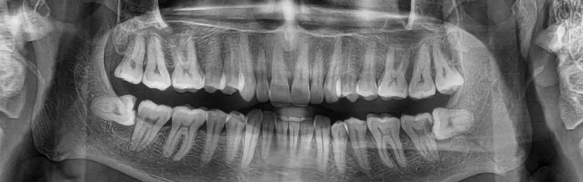 Multi Slice CT Scanning